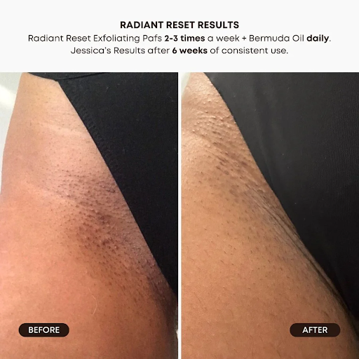 Bushbalm Radiant Reset Exfoliating Toner Pads