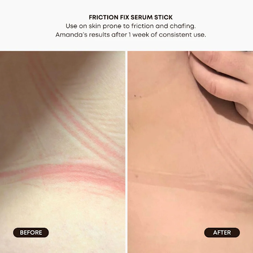 Bushbalm Friction Fix